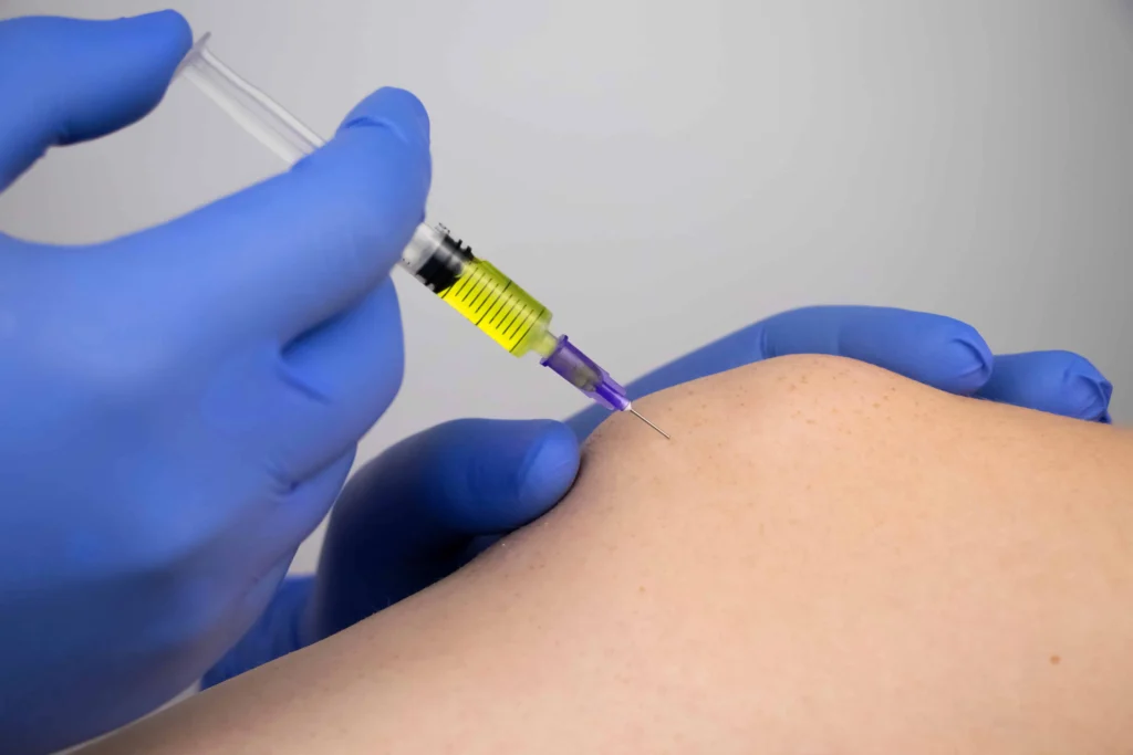 Platelet-Rich Plasma (PRP) Therapy